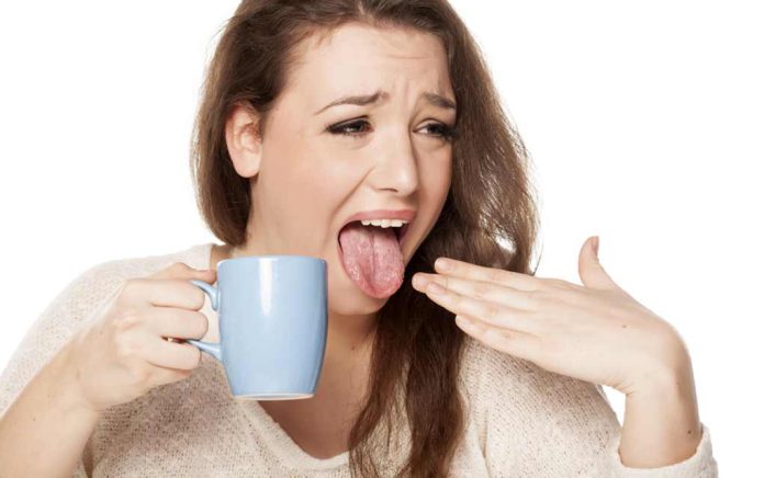 How-to-Heal-a-Burnt-Tongue-Quickly How to Heal a Burnt Tongue Quickly