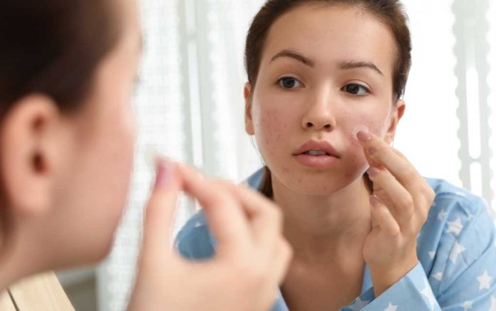 Skin-Care-Hacks-for-a-Clear-Complexion Skin-Care Hacks For A Clear Complexion