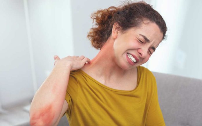 7-Signs-of-Anaphylaxis 7 Signs of Anaphylaxis